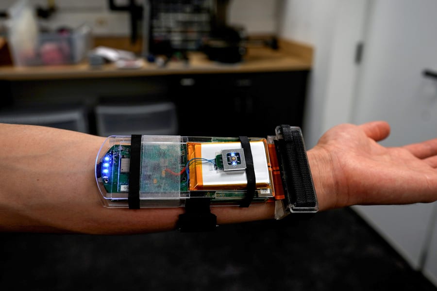 Ultrasound wristband lets wearers control a robotic hand